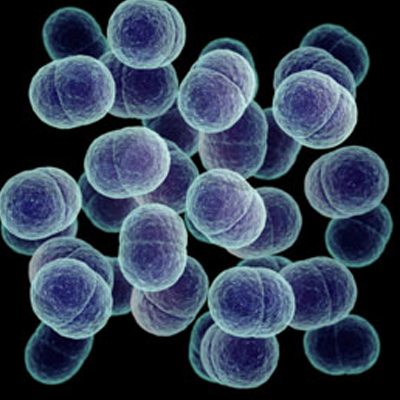 Anaerobik Bakteri Sayısı Tayini