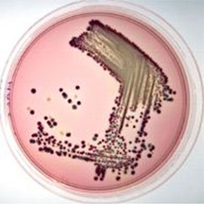 E. coli O157:H7 bakteri türü, gram negatif, fakültatif anaerob, 37 derecede ve pH 7,2 değerinde optimum düzeyde üreyen, hareketli ve ısı uygulamalarına direnci olmayan bir bakteridir. Escherichia coli bakterisinin O157:H7 türünün tespit edilmesi için iki farklı analiz yöntemi uygulanmaktadır. Bir grup analizler klasik analiz yöntemleridir. Bir grup analizler ise hızlı yöntemlerdir. Klasik analiz yöntemleri, seçici zenginleştirme ve katı besiyerinlerine ekim yapılarak gerçekleştirilmektedir. Türk Gıda Kodeksi esaslarına göre gıdalarda E. coli O157:H7 bakterisinin varlığı 25 gram örnekte araştırılmaktadır. Test örnekleri aseptik koşullarda alınmakta ve soğuk zincir korunarak laboratuvara getirilmektedir. E. coli O157:H7 analizlerine hızlı testler için immun akış prensibi ile hazırlanan immunolojik test kitleri kullanılmaktadır. Selektif zenginleştirme besiyeri kültüründen alınan koloninin su içindeki suspansiyonu, kaynar suda 15 dakika kadar tutulmakta ve sonra oda sıcaklığına getirilmektedir. Daha sonra bu suspansiyondan belli bir mikar alınarak kitin gözüne konmakta ve oda sıcaklığında 20 dakika bekletilmektedir. Bu süre içinde kit üzerinde kırmızı bir şerit oluşmalıdır. Bu kırmızı şerit test örneğinde E. coli O157:H7 bulunduğunu göstermektedir. Ön zenginleştirme adımından sonra yaklaşık yarım saat içinde sonuç verdiği için bu kitlere hızlı kit denmektedir. Ancak bu kit ile elde edilen pozitif sonuç, sadece escherichia coli O157:H7 türü içindir. Bu bakteri türünün doğrulaması için de H7 antiserumu kullanmak gerekmektedir. Gelişmiş laboratuvarlarda, mikrobiyolojik analizler çerçevesinde, E. coli O157:H7 tayinine yönelik hızlı testler yapılmaktadır. Bu çalışmalar sırasında yerli ve yabancı standartlar ve analiz yöntemleri esas alınmaktadır. Bu konuda dkkate alınan standart ise şudur: •	TS EN ISO 16654 Gıda ve hayvan yemlerinin mikrobiyolojisi - Eschericha coli O157’nin tespiti için yatay yöntem
