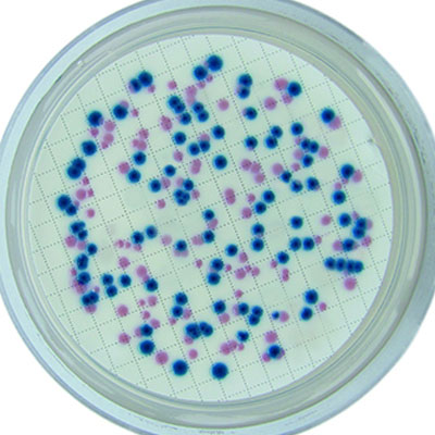 Listeria Monocytogenes Aranması (Hızlı Test)