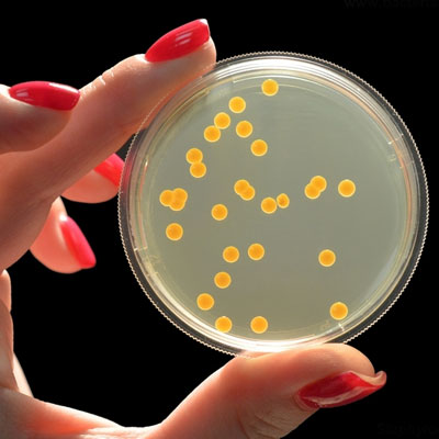 Staphylococcus Aureus (Koagülaz Pozitif Staphylococ) Tayini